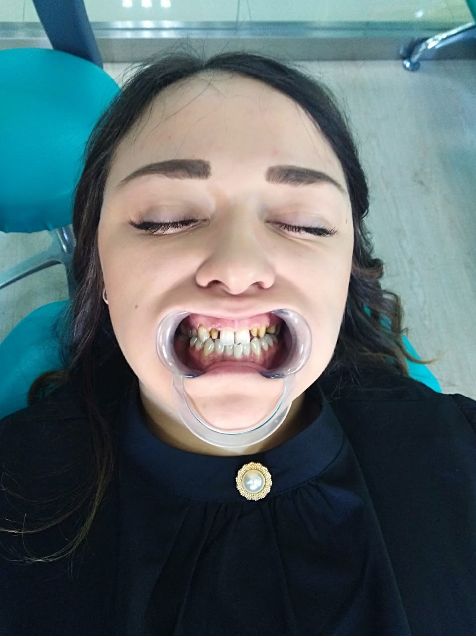 девушка сделала зубы в Китае